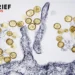 Хантавірус: що це за смертельний вірус, симптоми, Andes virus та спалах на лайнері