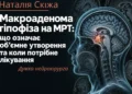 мікроаденома наталія скіжа 00